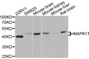 Western blot analysis of extracts of various cells, using MAPK11 antibody.