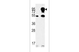 Western blot analysis of BRAF Antibody (Center) polyclonal antibody (ABIN392246 and ABIN2841936) (arrow). (SNRPE 抗体  (AA 424-453))