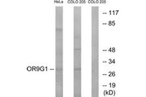 Western blot analysis of extracts from HeLa/COLO cells, using OR9G1 Antibody. (OR9G1 抗体  (AA 158-207))