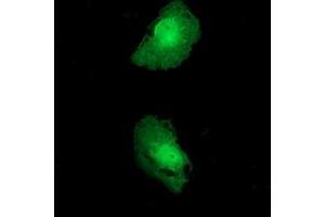 Anti-FKBPL mouse monoclonal antibody (ABIN2453045) immunofluorescent staining of COS7 cells transiently transfected by pCMV6-ENTRY FKBPL (RC202153). (FKBPL 抗体)