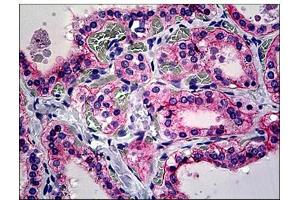 Human Thyroid: Formalin-Fixed, Paraffin-Embedded (FFPE) (CD51 抗体  (C-Term))