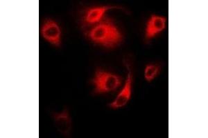 Immunofluorescent analysis of CD27 staining in MCF7 cells. (CD27 抗体)