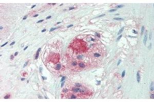Detection of CSPG4 in Human Small Intestine Tissue using Monoclonal Antibody to Chondroitin Sulfate Proteoglycan 4 (CSPG4) (NG2 抗体  (AA 559-776))