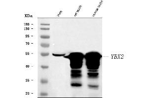 Western blot analysis of MSY2/YBOX2/YBX2 using anti-MSY2/YBOX2/YBX2 antibody (ABIN7600636).