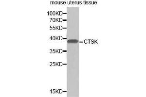 Western Blotting (WB) image for anti-Cathepsin K (CTSK) (AA 115-329) antibody (ABIN3022539) (Cathepsin K 抗体  (AA 115-329))