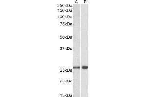 ABIN2563900 (0. (MOBKL3 抗体  (AA 137-151))