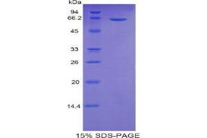 SDS-PAGE analysis of Human Sulfatase 2 Protein. (SULF2 蛋白)