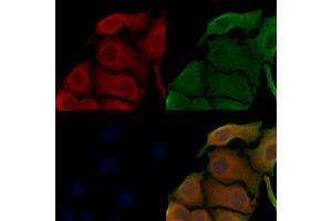 ABIN6258695 and ABIN6273499 staining Hela cells by IF/ICC. (TAB2 抗体  (Internal Region))