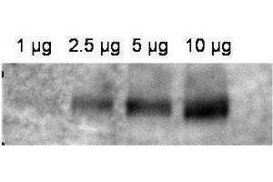 Western Blotting (WB) image for anti-ATP-Binding Cassette, Sub-Family B (MDR/TAP), Member 1 (ABCB1) (AA 255-280) antibody (ABIN129711)
