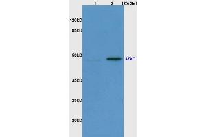 Lane 1: mouse embryo lysates Lane 2: mouse brain lysates probed with Anti Phospho-Smad3(Ser423/425) Polyclonal Antibody, Unconjugated (ABIN746138) at 1:200 in 4 °C. (SMAD3 抗体  (pSer423, pSer425))