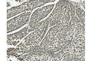 IHC analysis of NDUFB10 using anti-NDUFB10 antibody (ABIN7601461).