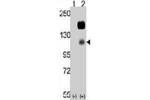 Western blot analysis of CCK4 (arrow) using rabbit PTK7 polyclonal antibody . (PTK7 抗体  (N-Term))