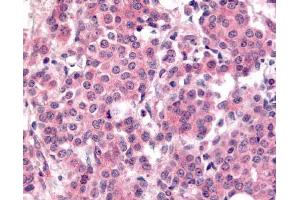 Immunohistochemistry. (PLK1 抗体  (pThr210))