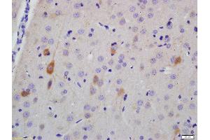 Formalin-fixed and paraffin embedded rat brain labeled with Anti-NF-H Polyclonal Antibody, Unconjugated  at 1:200 followed by conjugation to the secondary antibody and DAB staining (NEFH 抗体  (AA 21-120))