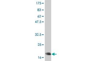Western Blot detection against Immunogen (21 KDa) . (IL-6 抗体  (AA 29-212))
