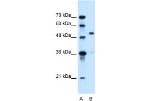 WB Suggested Anti-SLC37A3 Antibody Titration:  0. (SLC37A3 抗体  (Middle Region))