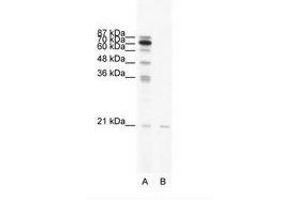 Image no. 1 for anti-SCAN Domain Containing 1 (SCAND1) (AA 65-114) antibody (ABIN6736033) (SCAND1 抗体  (AA 65-114))