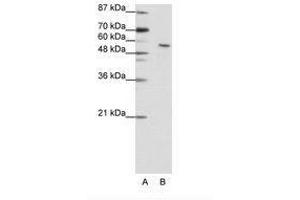 Image no. 1 for anti-Insulinoma-Associated 2 (INSM2) (N-Term) antibody (ABIN202769) (INSM2 抗体  (N-Term))