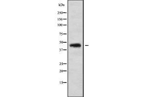 Western blot analysis of CCBE1 using HUVEC whole cell lysates (CCBE1 抗体  (Internal Region))