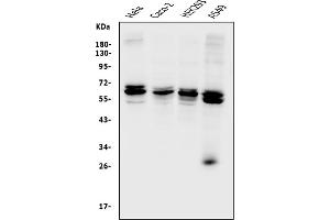 Western blot analysis of CDR2 using anti-CDR2 antibody (ABIN7599397).