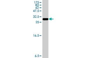 Western Blot detection against Immunogen (33. (HSD17B12 抗体  (AA 203-271))