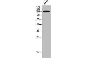 Western Blot analysis of A549 cells using Rhophilin Polyclonal Antibody (RHPN1 抗体  (Internal Region))