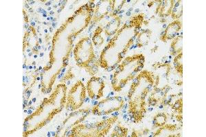 Immunohistochemistry of paraffin-embedded Rat kidney using HSPA9 Polyclonal Antibody at dilution of 1:100 (40x lens). (HSPA9 抗体)