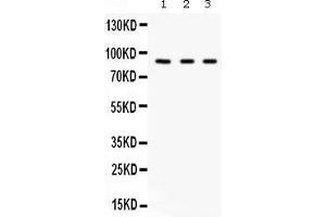 Western blot analysis of Factor B expression in A549 whole cell lysates ( Lane 1), 293T whole cell lysates ( Lane 2) and HELA whole cell lysates ( Lane 3). (Complement Factor B 抗体  (AA 518-764))