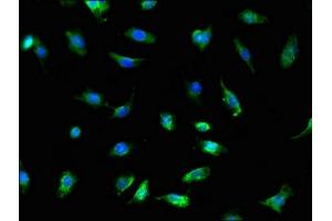 Immunofluorescence (IF) image for anti-TNFRSF1A-Associated Via Death Domain (TRADD) (AA 1-312) antibody (ABIN7173904)