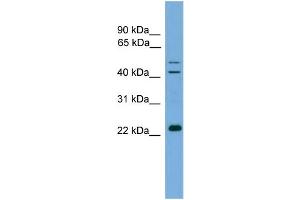 WB Suggested Anti-CHP  Antibody Titration: 0. (CHP 抗体  (N-Term))