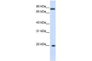 IFN Alpha 7 antibody used at 1 ug/ml to detect target protein. (IFNA7 抗体  (N-Term))