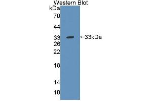 Figure. (Tec Protein Tyrosine Kinase (TEC) (AA 370-623) 抗体)
