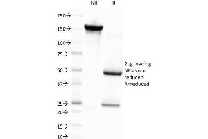 SDS-PAGE Analysis Purified EBV Mouse Monoclonal Antibody (CS4). (EBV LMP1 抗体)