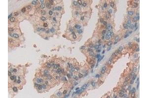 Detection of gSAP in Human Prostate Tissue using Polyclonal Antibody to Gamma-Secretase Activating Protein (gSAP) (GSAP 抗体  (AA 616-854))