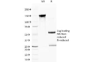 SDS-PAGE Analysis Purified CD59 Mouse Monoclonal Antibody (BRA-10G). (CD59 抗体)