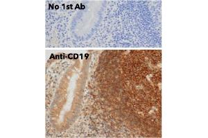 Immunohistochemistry (IHC) image for anti-CD19 Molecule (CD19) (C-Term) antibody (ABIN6254219) (CD19 抗体  (C-Term))