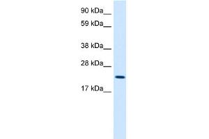 WB Suggested Anti-MYCL1 Antibody Titration:  2. (LMYC 抗体  (Middle Region))