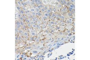 Immunohistochemistry (IHC) image for anti-Basigin (Ok Blood Group) (BSG) (AA 30-200) antibody (ABIN1512647)