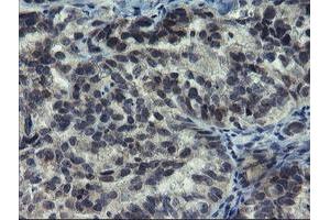 Image no. 1 for anti-Negative Regulator of Ubiquitin-Like Proteins 1 (NUB1) (AA 1-326) antibody (ABIN1490744) (NUB1 抗体  (AA 1-326))