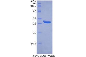 SDS-PAGE (SDS) image for ATP-Binding Cassette, Sub-Family G (WHITE), Member 1 (ABCG1) (AA 79-312) protein (His tag) (ABIN1879613) (ABCG1 Protein (AA 79-312) (His tag))