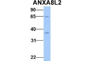 Host:  Rabbit  Target Name:  ANXA8L2  Sample Type:  Human Fetal Heart  Antibody Dilution:  1. (ANXA8L2 抗体  (Middle Region))