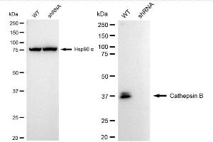 anti-Cathepsin B (CTSB) antibody