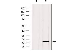 Western blot analysis of extracts from Rat muscle, using GMFG Antibody. (GMFG 抗体  (Internal Region))