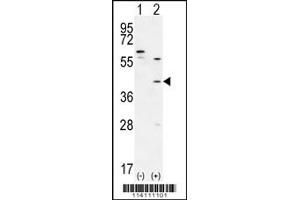Western blot analysis of TGIF1 using rabbit polyclonal using 293 cell lysates (2 ug/lane) either nontransfected (Lane 1) or transiently transfected (Lane 2) with the TGIF1 gene. (TGIF1 抗体  (AA 145-174))