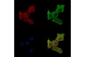 Phospho-EIF3J (Ser127) Antibody staining HepG2 cells(serum starvation treatment) by IF/ICC. (EIF3S1 抗体  (pSer127))