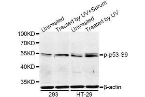 Western Blotting (WB) image for anti-Tumor Protein P53 (TP53) (pSer9) antibody (ABIN3023604)