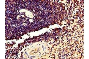 Immunohistochemistry of paraffin-embedded human spleen tissue using ABIN7173031 at dilution of 1:100 (TMEM11 抗体  (AA 1-83))