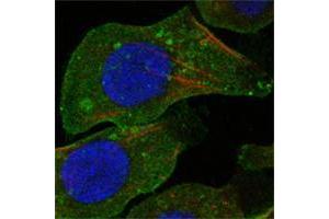 Confocal immunofluorescence analysis of A549 cells using DDR2 mouse mAb (green). (DDR2 抗体)