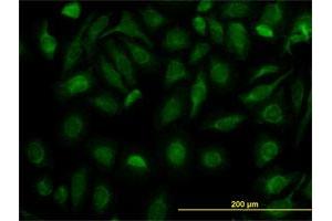Immunofluorescence (IF) image for anti-Fumarate Hydratase (FH) (AA 33-510) antibody (ABIN515650)