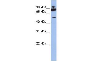 WB Suggested Anti-IKZF1 Antibody Titration:  0. (IKZF1 抗体  (Middle Region))